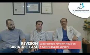 Patient Testimonial - Revision Bariatric Surgery by Dr Randeep Wadhawan